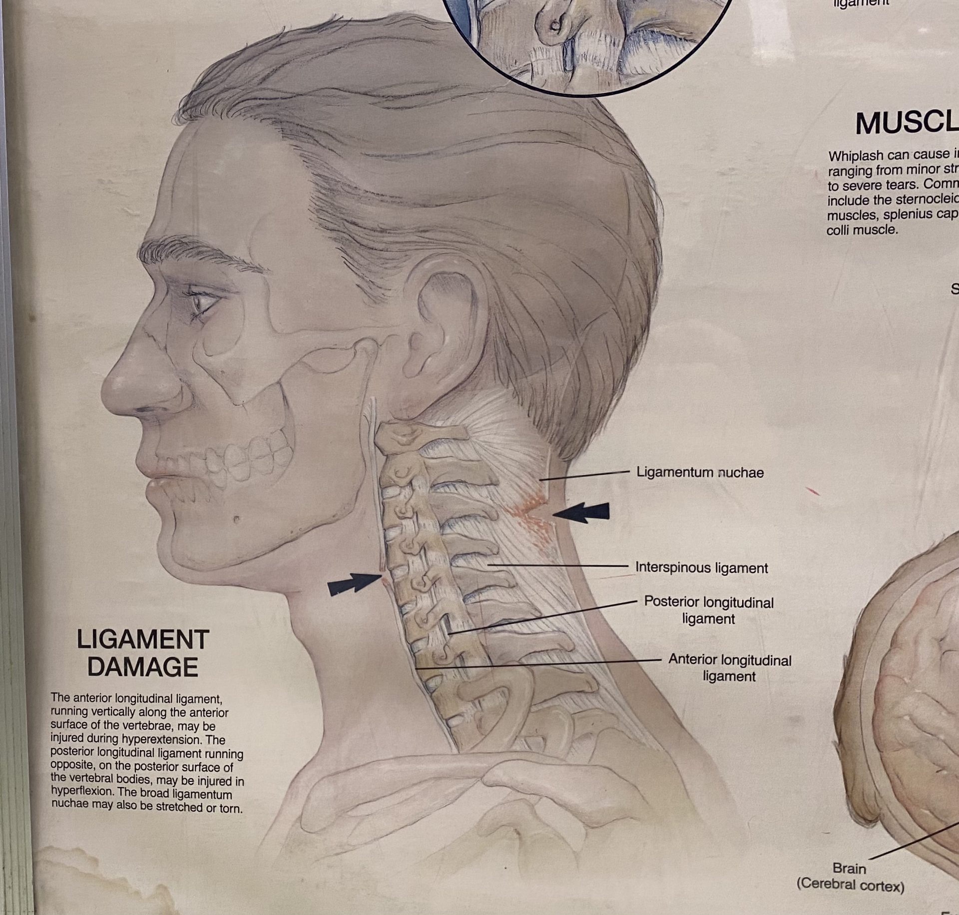 鞭打ち損傷と周辺疾患 査定実務家のために 井上久